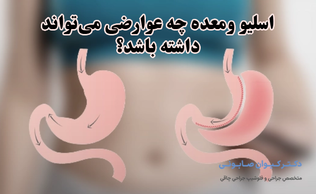 اسلیو ومعده چه عوارضی میتواند داشته باشد؟