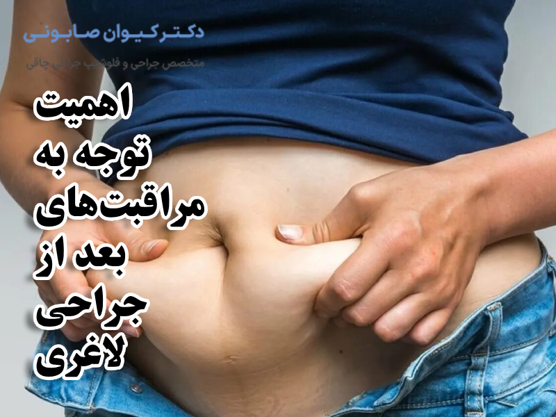 اهمیت توجه به مراقبتهای بعد از جراحی لاغری