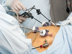 جراحی لاغری