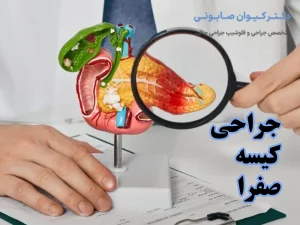 جراحی کیسه صفرا