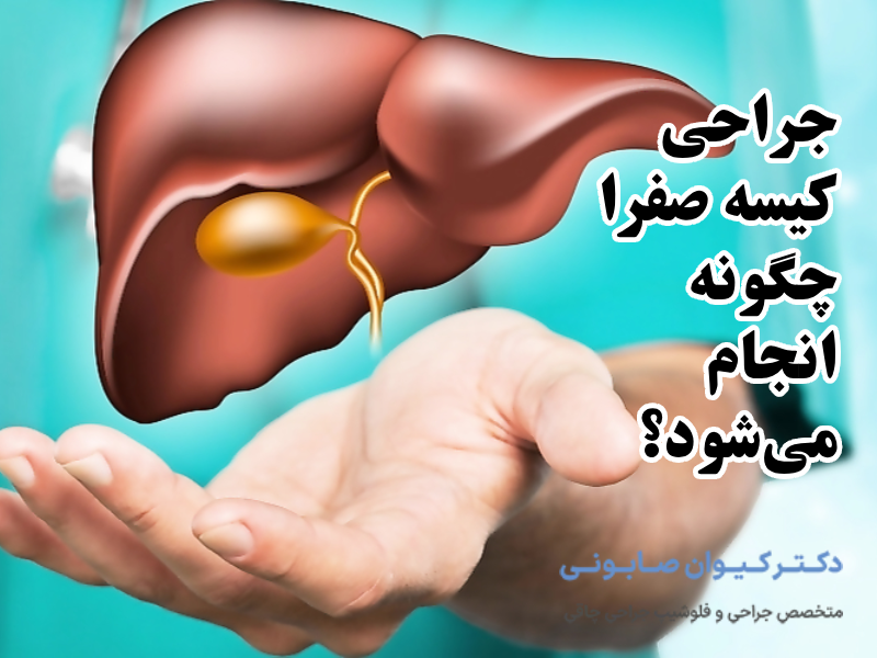 جراحی کیسه صفرا چگونه انجام میشود؟