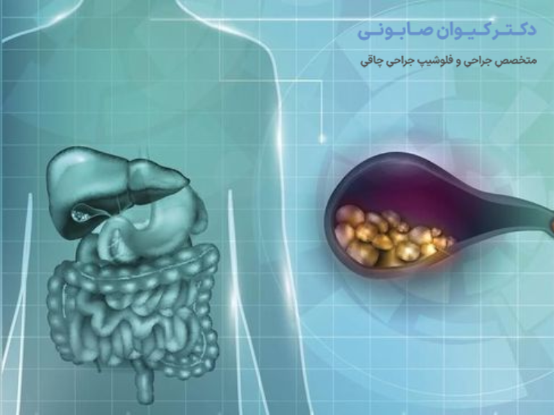 علت بوجود آمدن مشکلات کیسه صفرا چیست؟