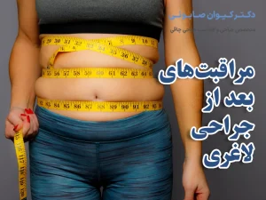مراقبت‌های بعد از جراحی لاغری