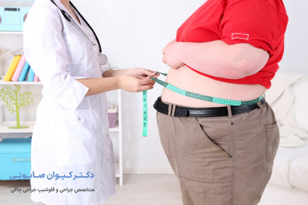 با مینی بای پس چقدر وزن کم میکنیم؟