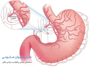 بستن رگ اشتها- شاخص
