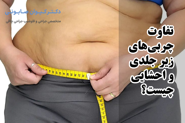 تفاوت چربیهای زیر جلدی و احشایی چیست؟