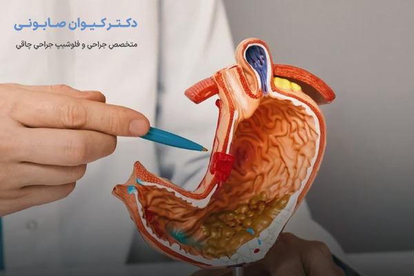 رگ اشتها یا شریان اصلی معده چیست؟