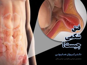 فتق شکم-شاخص