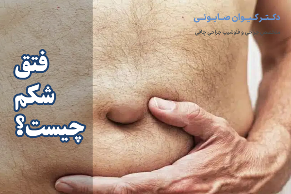 فتق شکم چیست؟