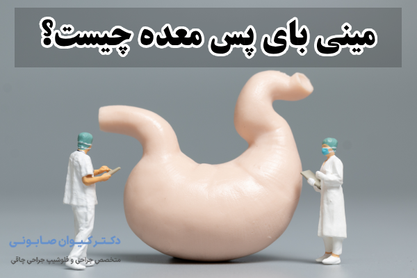 مینی بای پس معده چیست؟