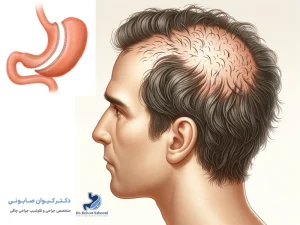 درمان ریزش مو بعد از جراحی لاغری: جلوگیری از عوارض آزاردهنده