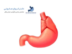 عمل ساسج بای پس در سنندج