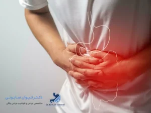 معده درد بعد از جراحی لاغری؛ علل، علائم، درمان و پیشگیری