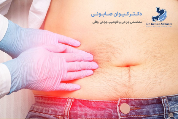 مهم ترین مراقبتهای بعد از جراحی کیسه صفرا