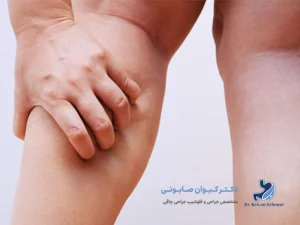 پا درد بعد از اسلیو معده