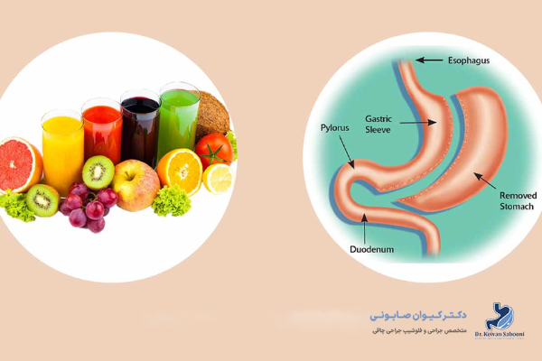 آیا مصرف نوشابه بعد از اسلیو معده باعث زخم معده میشود؟