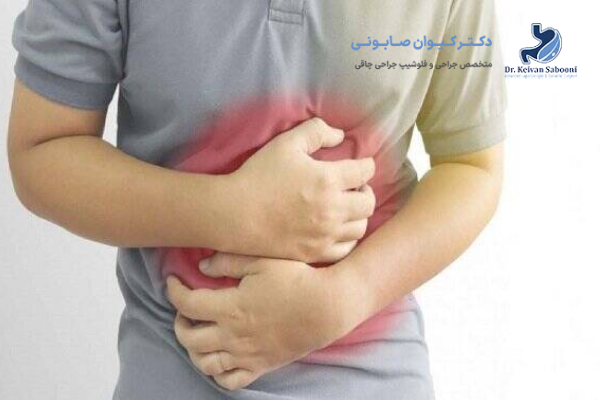 تفاوت عوارض برداشتن کیسه صفرا در مردان و زنان