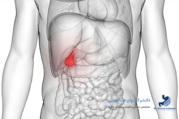 خطرات عمل برداشتن کیسه صفرا