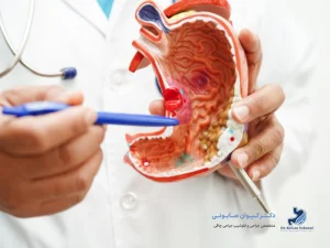 عوارض برداشتن کیسه صفرا؛ بعد از عمل چه میشود؟