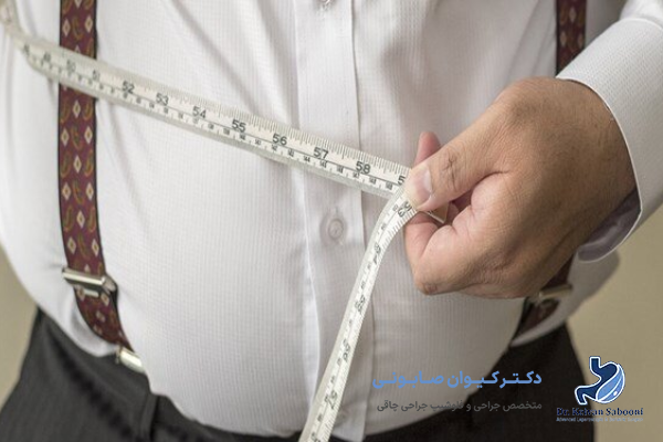 چه کسانی باید جراحی بای پس روده انجام دهند؟