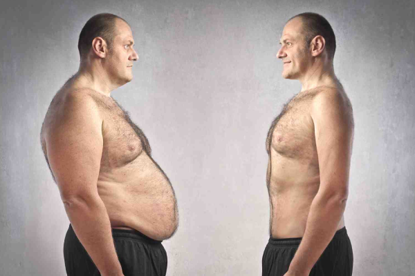 اسلیو معده یا پیکرتراشی : کدام روش برای من بهتر است؟