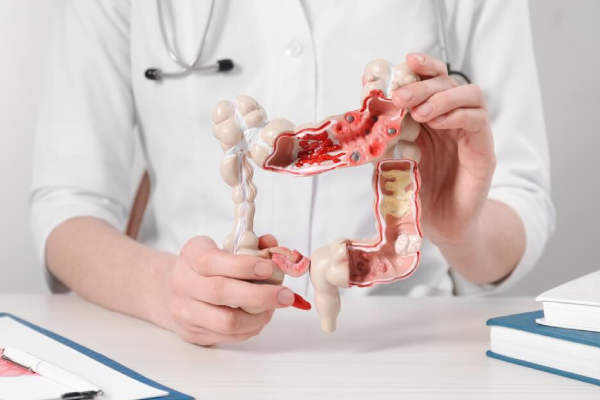 چسبندگی روده چیست و چگونه ایجاد میشود؟