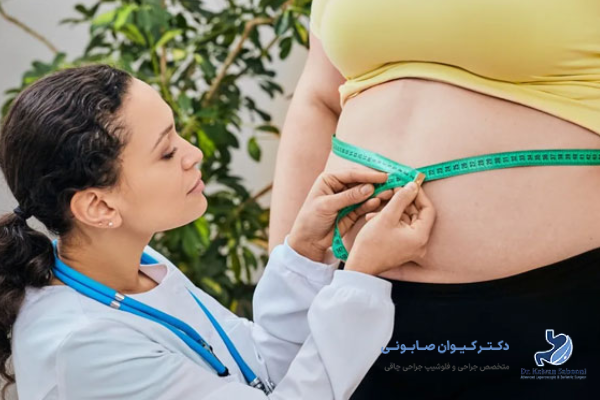 اهمیت اقدامات قبل از جراحی اسلیو معده