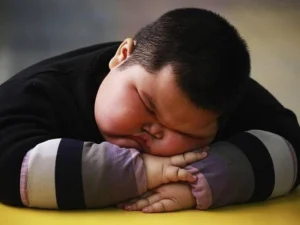 شرایط و مزایای جراحی لاغری کودکان