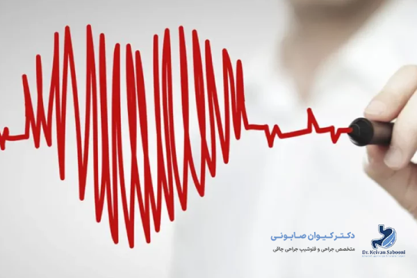 پیشگیری از تپش قلب بعد از اسلیو معده