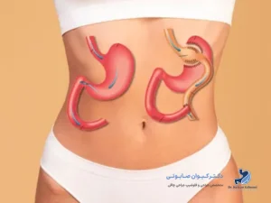 تفاوت جراحی لاغری و ابدومینوپلاستی-شاخص