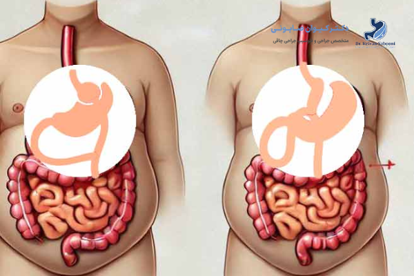 تفاوت در برگشت پذیری