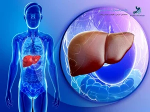 درمان کبد چرب با جراحی لاغری