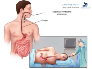 آندوسکوپی قبل از اسلیو معده