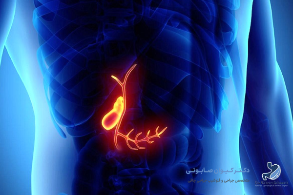 تفاوت علائم پر شدن کیسه صفرا با سنگ صفرا