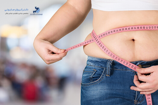 چاقی هورمونی