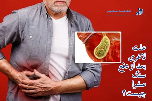چرا بعد از دفع سنگ صفرا لاغری اتفاق میافتد؟