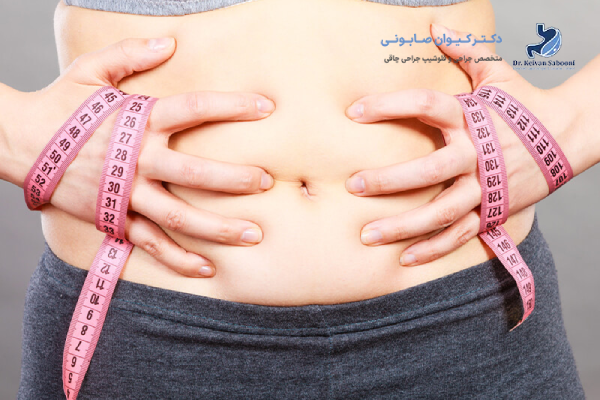 گشاد شدن معده بعد از بای پس به چه معناست؟