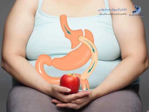 تغذیه بعد از جراحی بای پس معده چرا حیاتی است؟