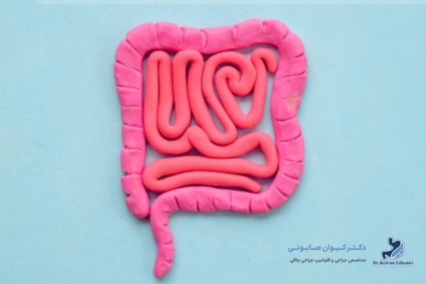 علائم یبوست بعد از عمل اسلیو چیست