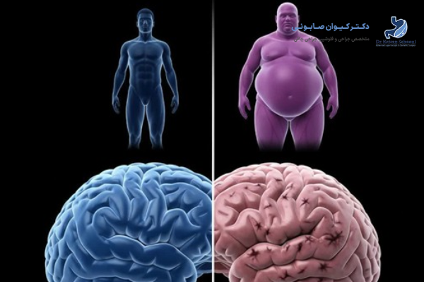 نقش هورمونها در ارتباط بین چاقی و مغز