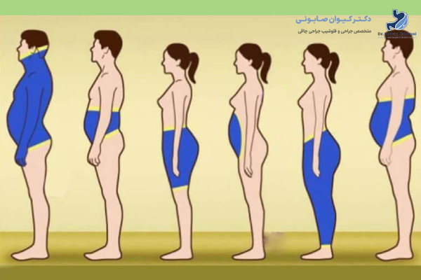 نقش هورمونها در چاقی زنان