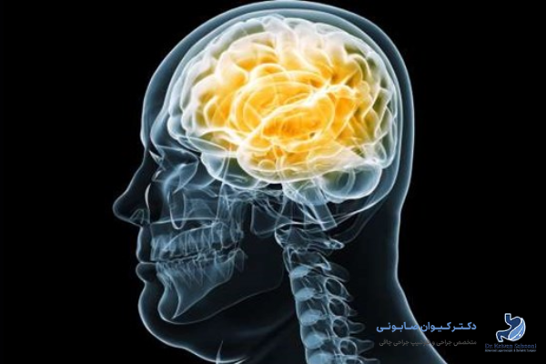 چاقی چگونه بر مغز تاثیر میگذارد؟