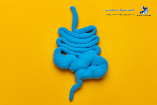 یبوست بعد از اسلیو معده چیست