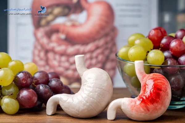 چه کسانی بهتر است مصرف انگور را محدود کنند؟